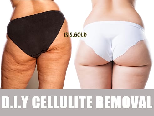 woman with cellulite on buttock and thighs, how to get rid of cellulite before and after, how to get rid of cellulite on thighs and buttocks, cellulite reduction